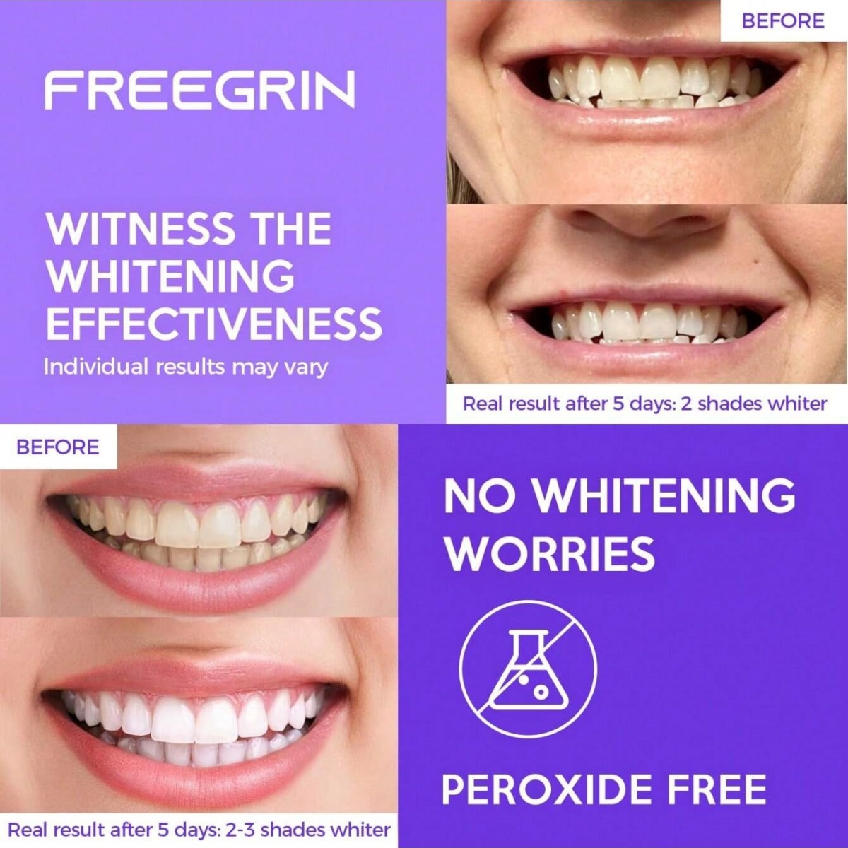 Deluxe Whitening Teeth Sticker - огляд і ціна Teeth Whitening Near Me